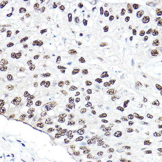 NBS1 Antibody in Immunohistochemistry (Paraffin) (IHC (P))