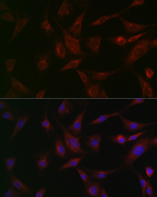 NSF Antibody in Immunocytochemistry (ICC/IF)