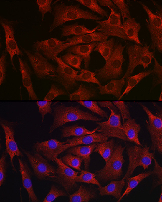 MARCKS Antibody in Immunocytochemistry (ICC/IF)