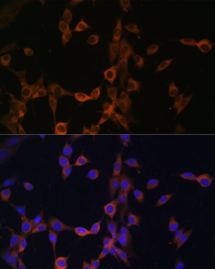 Calcineurin B Antibody in Immunocytochemistry (ICC/IF)
