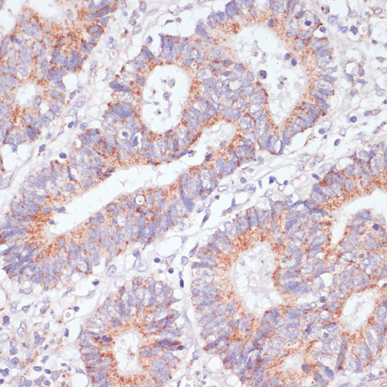RAP1A Antibody in Immunohistochemistry (Paraffin) (IHC (P))
