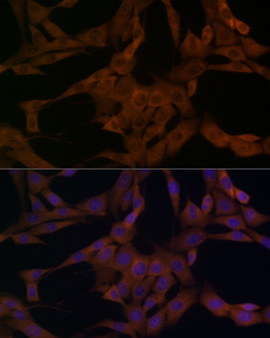 beta Arrestin 1 Antibody in Immunocytochemistry (ICC/IF)