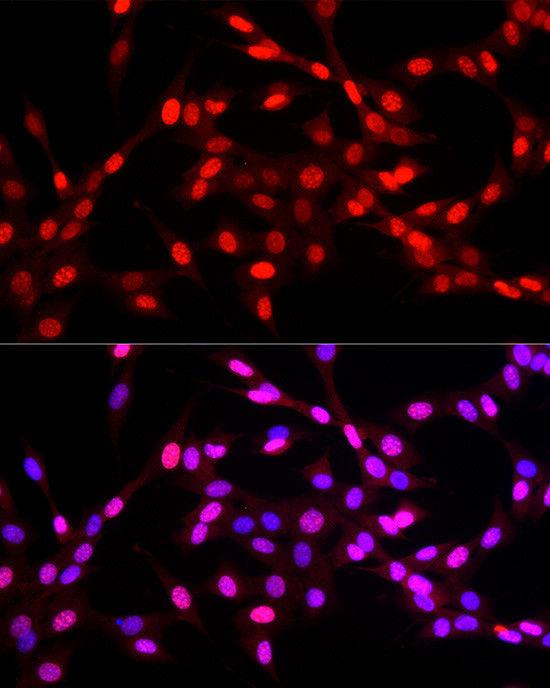 KLF6 Antibody in Immunocytochemistry (ICC/IF)