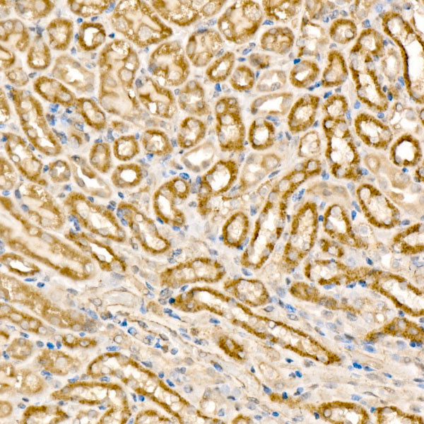 MCCC1 Antibody in Immunohistochemistry (Paraffin) (IHC (P))