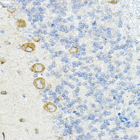 LRRC59 Antibody in Immunohistochemistry (Paraffin) (IHC (P))