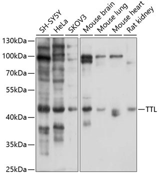 TTL Antibody in Western Blot (WB)