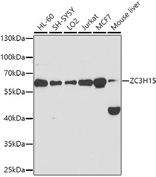 ZC3H15 Antibody in Western Blot (WB)