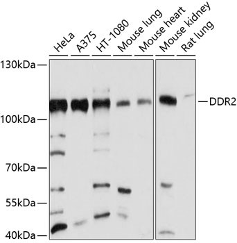 DDR2 Antibody in Western Blot (WB)