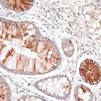 KIR3DL3 Antibody in Immunohistochemistry (Paraffin) (IHC (P))