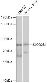 SLCO2B1 Antibody in Western Blot (WB)
