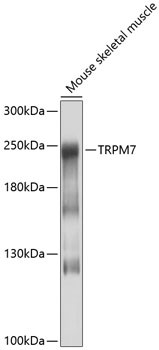 TRPM7 Antibody in Western Blot (WB)