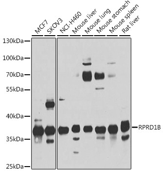 RPRD1B Antibody in Western Blot (WB)