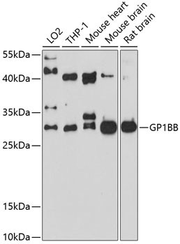 GP1BB Antibody in Western Blot (WB)