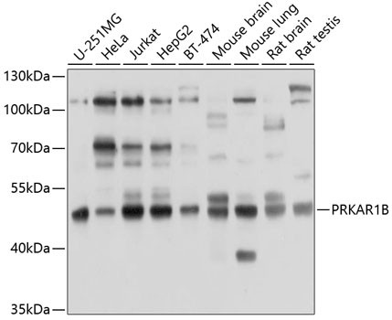 PRKAR1B Antibody in Western Blot (WB)