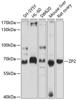 ZP2 Antibody in Western Blot (WB)