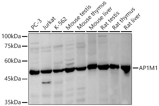 AP1M1 Antibody in Western Blot (WB)