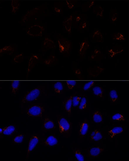 ETHE1 Antibody in Immunocytochemistry (ICC/IF)