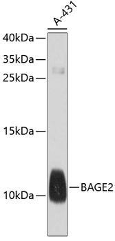 BAGE2 Antibody in Western Blot (WB)