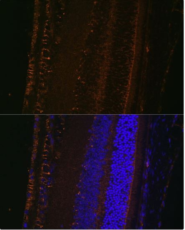 LOXL1 Antibody in Immunocytochemistry (ICC/IF)