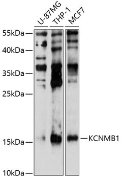 KCNMB1 Antibody in Western Blot (WB)