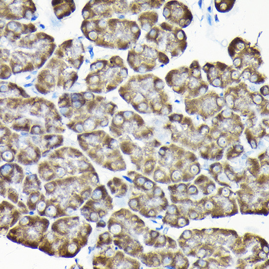 RPS15A Antibody in Immunohistochemistry (Paraffin) (IHC (P))