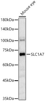 SLC1A7 Antibody in Western Blot (WB)