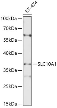 NTCP Antibody in Western Blot (WB)