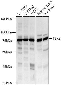 TBX2 Antibody in Western Blot (WB)