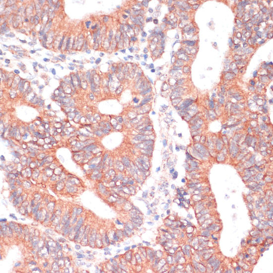 TIAM1 Antibody in Immunohistochemistry (Paraffin) (IHC (P))