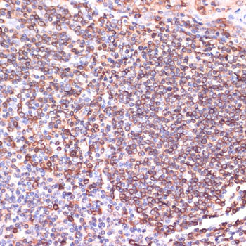 TPD52 Antibody in Immunohistochemistry (Paraffin) (IHC (P))
