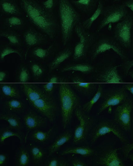 KIF14 Antibody in Immunocytochemistry (ICC/IF)