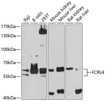 FCRL4 Antibody in Western Blot (WB)