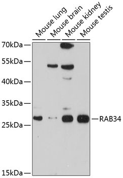 RAB34 Antibody in Western Blot (WB)