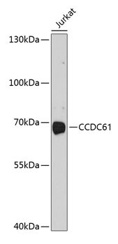CCDC61 Antibody in Western Blot (WB)