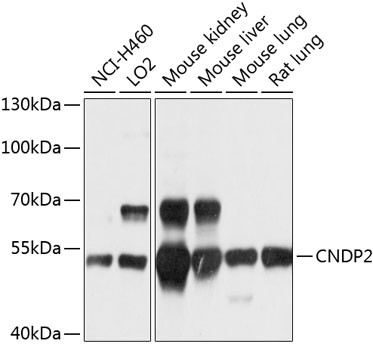 CNDP2 Antibody in Western Blot (WB)