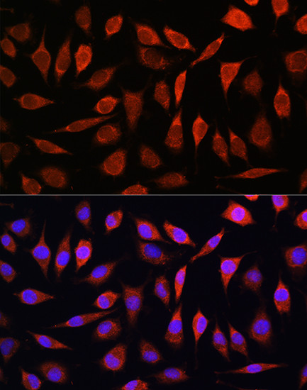 SLC39A8 Antibody in Immunocytochemistry (ICC/IF)