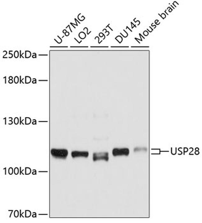 USP28 Antibody in Western Blot (WB)