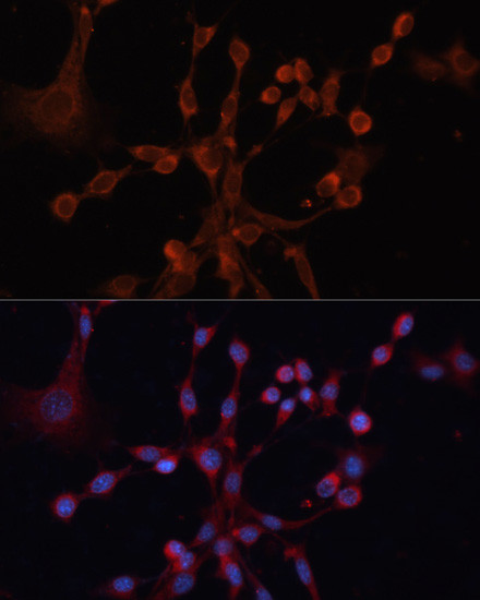 GNA14 Antibody in Immunocytochemistry (ICC/IF)