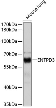 ENTPD3 Antibody in Western Blot (WB)