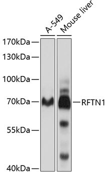 RFTN1 Antibody in Western Blot (WB)