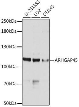 HMHA1 Antibody in Western Blot (WB)