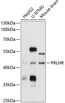 GPR10 Antibody in Western Blot (WB)