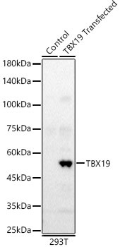 TBX19 Antibody in Western Blot (WB)