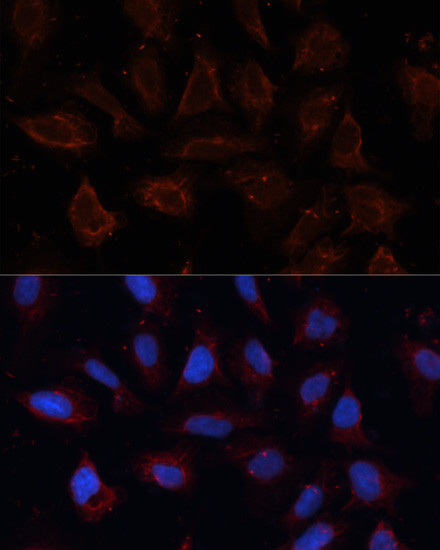 DOG-1 Antibody in Immunocytochemistry (ICC/IF)