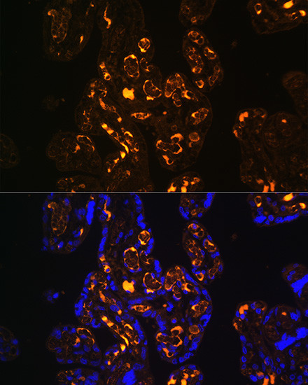 LRP8 Antibody in Immunohistochemistry (Paraffin) (IHC (P))