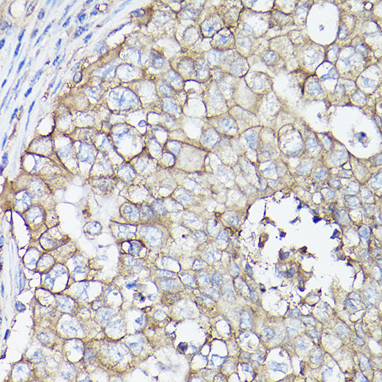 SLC16A3 Antibody in Immunohistochemistry (Paraffin) (IHC (P))