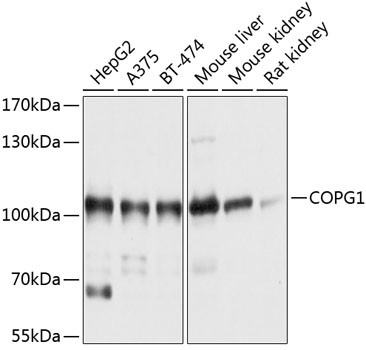 COPG Antibody in Western Blot (WB)
