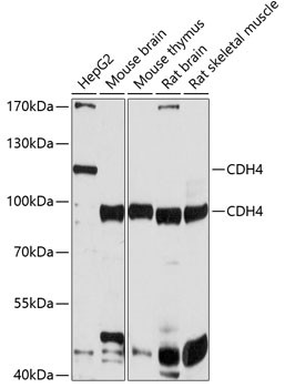 CDH4 Antibody in Western Blot (WB)