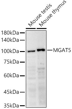 MGAT5 Antibody in Western Blot (WB)