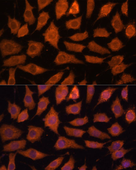 LGMN Antibody in Immunocytochemistry (ICC/IF)